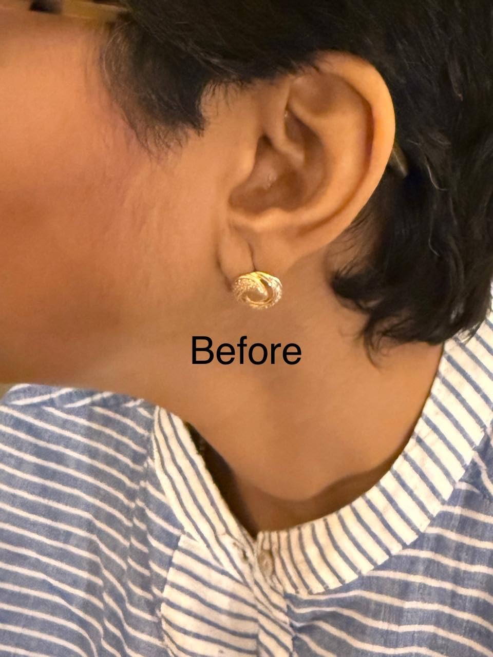 Before