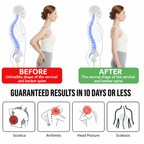 ✨ Smart Posture Corrector Back Support Belt ✨
