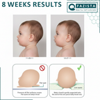 Premium Baby Head Shaping Pillow 👶✨ | Ultra Soft Comfort & Safe Support