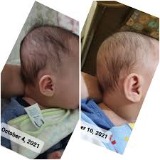 Premium Baby Head Shaping Pillow 👶✨ | Ultra Soft Comfort & Safe Support